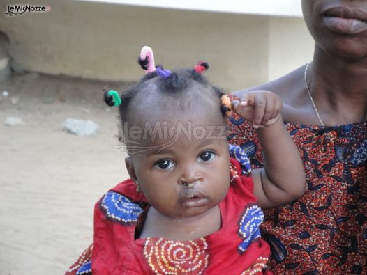Una dolcissima bambina affetta la labioschisi appena operata in Benin