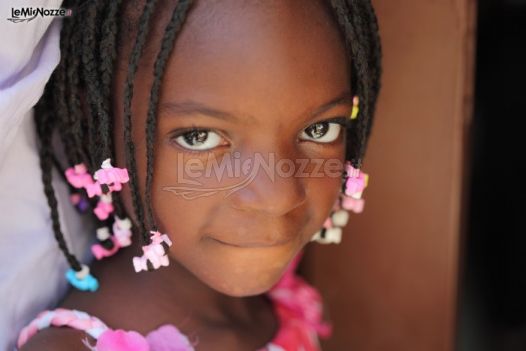 Una bambina curata da Emergenza Sorrisi