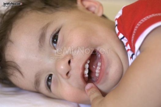 Un bambino afgano affetto da labiopalatoschisi operato in Italia