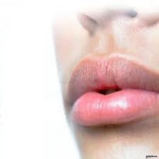 Studio Dentistico - Filler labbra per sposi
